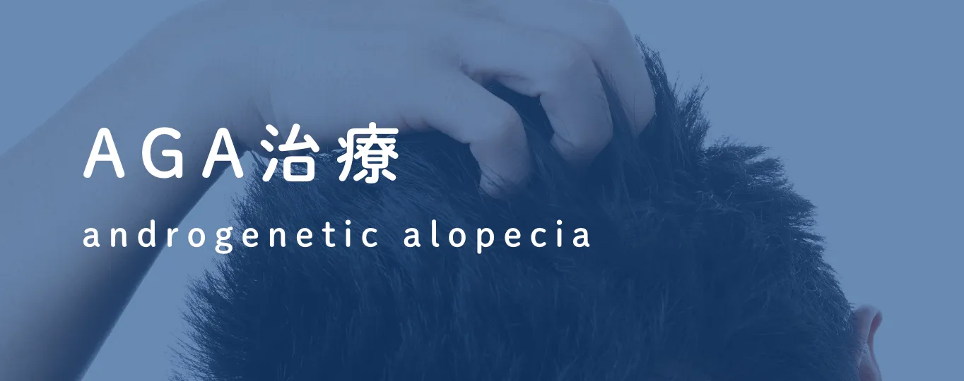 AGA治療